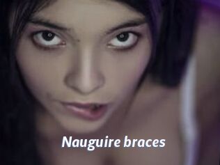 Nauguire_braces